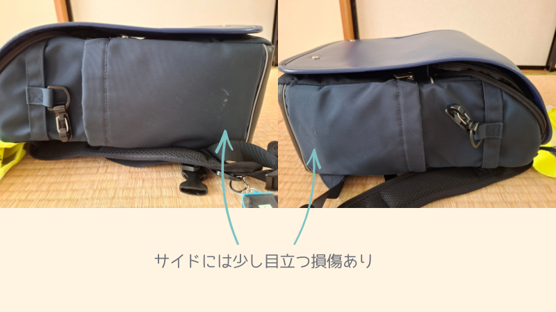 エアリュックのサイドの写真